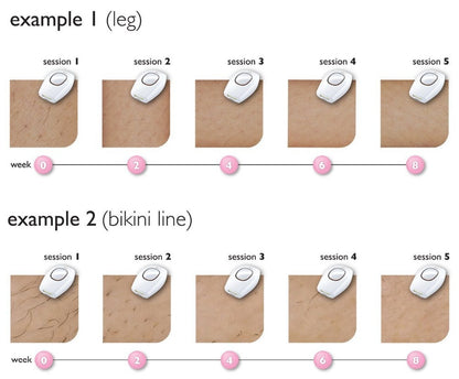 Popular hair removal device laser hair removal device IPL household women's shaving strong pulse hair removal device