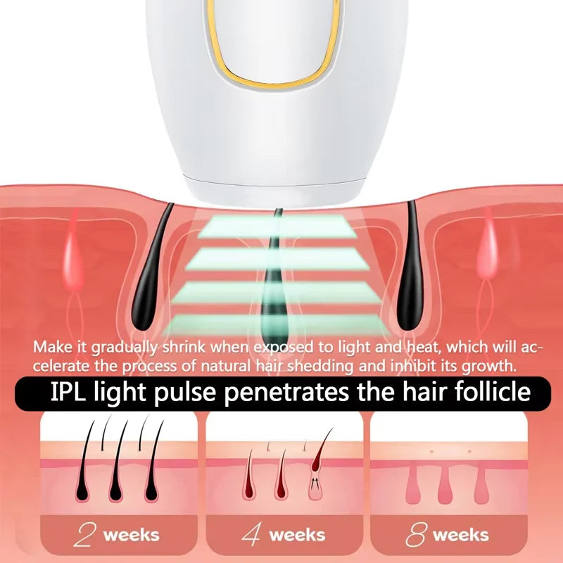 IPL laser freezing point hair removal instrument photon painless armpit hair leg hair lip hair skin rejuvenation device